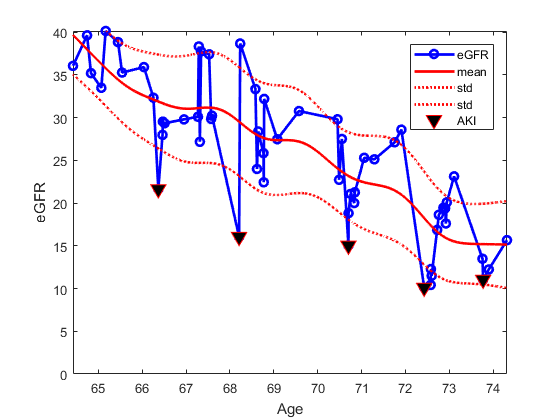 CKD progression with AKI