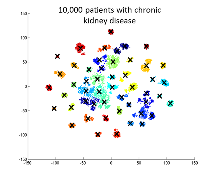 CKD Clustering using t-SNE algorithm